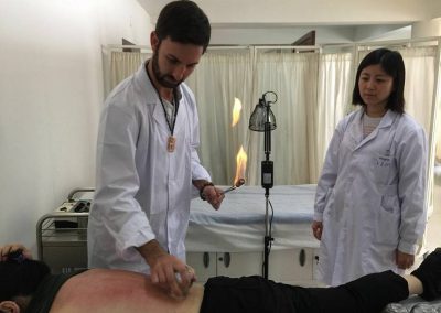 Tamarac Acupuncturist Cupping in Chinese Hospital