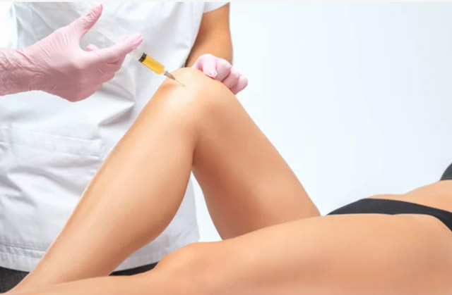 PRP Therapy in Coral Springs