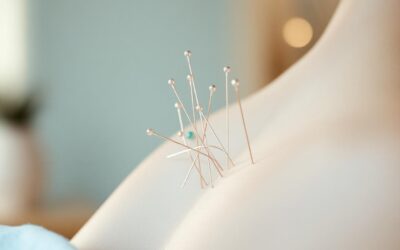Dry Needling vs Acupuncture