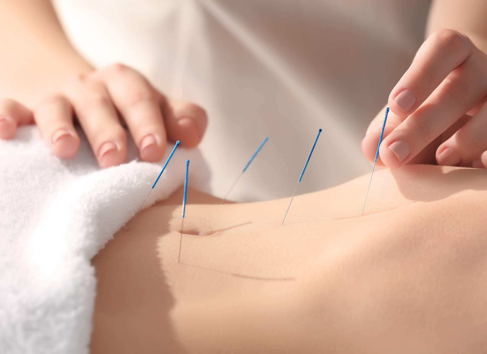 Acupuncture treatment for sleep in Coral Springs FL