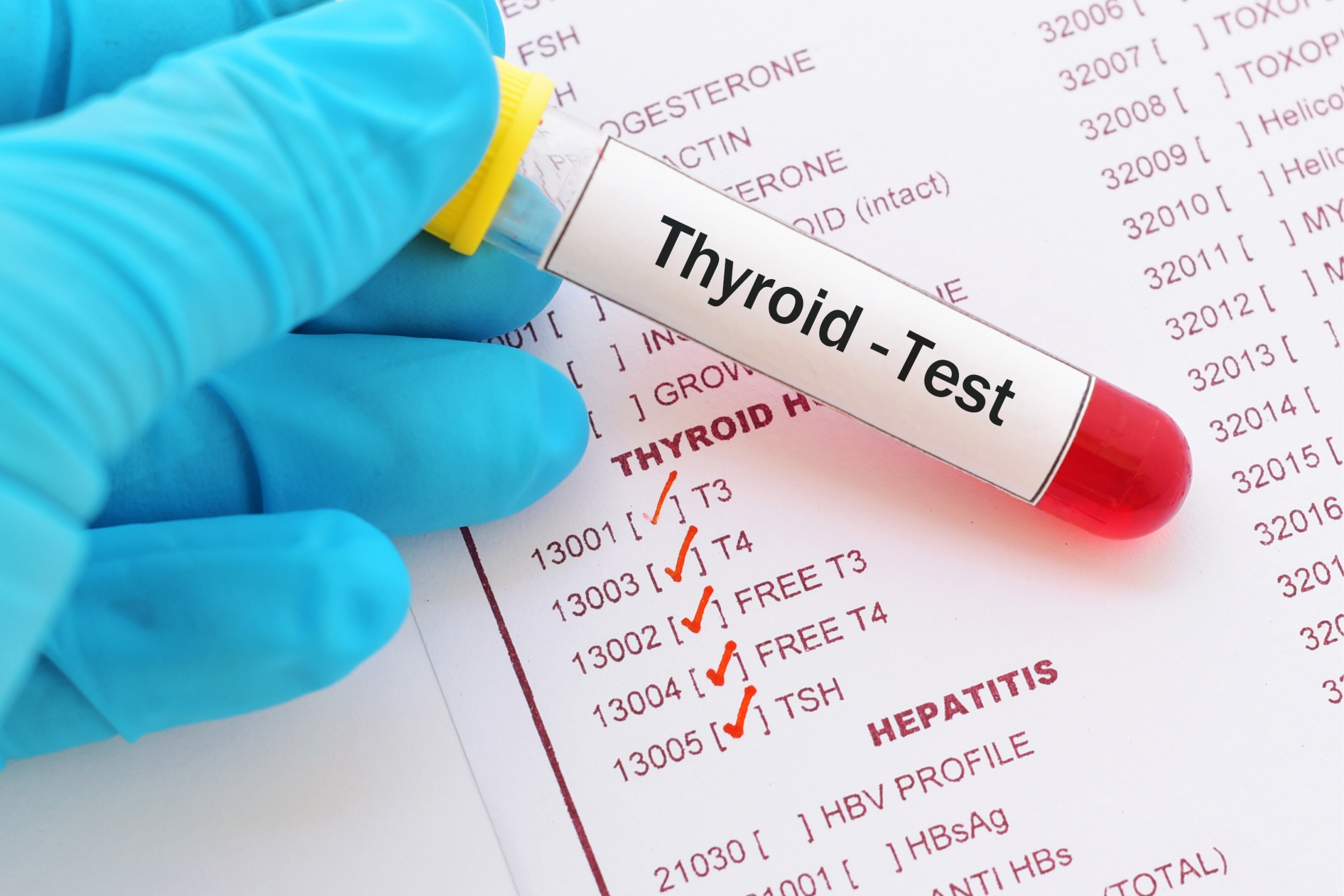 Woman reviewing thyroid lab results that came back normal while still experiencing fatigue, Coral Springs functional medicine
